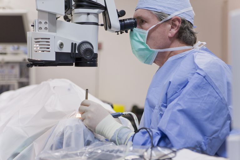 wordt uitgevoerd, cataract chirurgie, meestal uitgevoerd, verwijderd wordt, beide ogen
