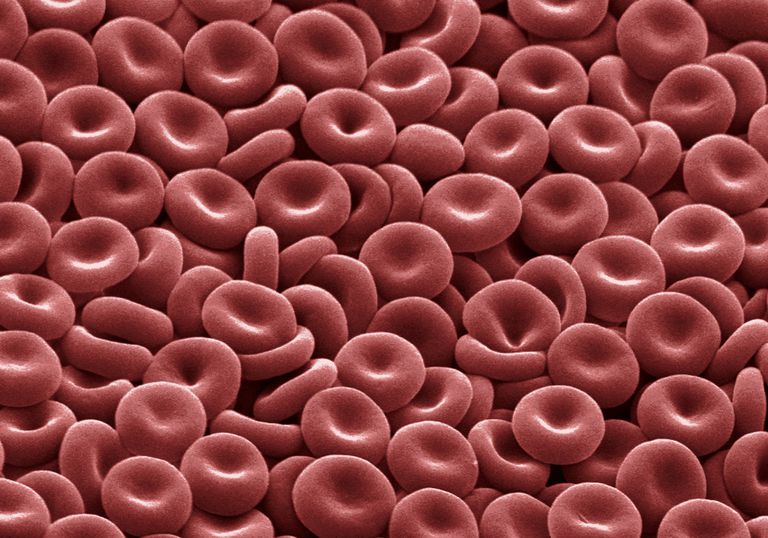 rode bloedcellen, bloedarmoede veroorzaken, aantal gezonde, aantal gezonde rode