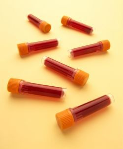 bloedverdunners gebruikt, tijdens operatie, type medicatie, worden bloedverdunners, worden bloedverdunners gebruikt, bekende risicofactor