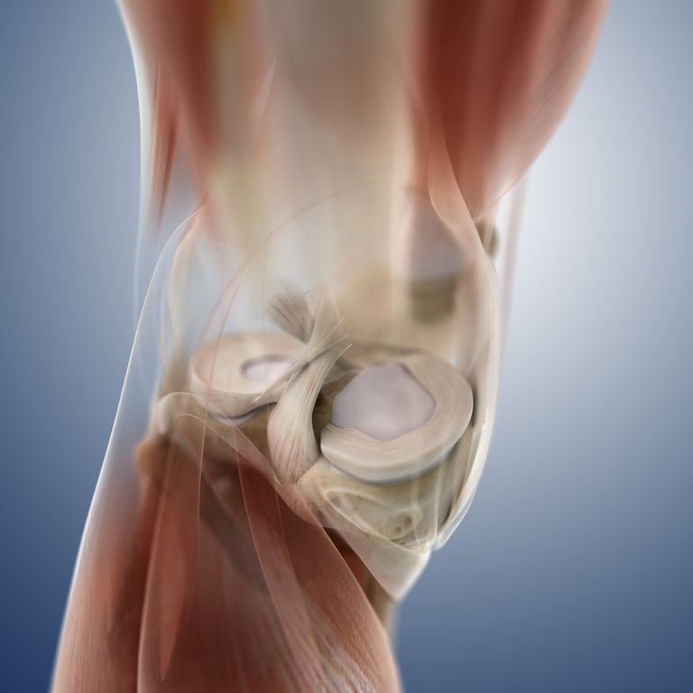 deel meniscus, gescheurde meniscus, emmer zijn, gescheurde deel, gescheurde deel meniscus, juiste positie
