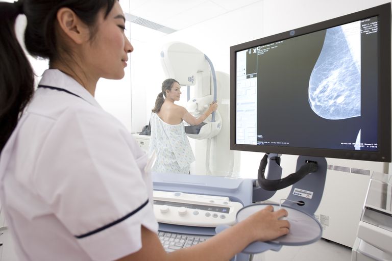 borstarteriële calcificatie, digitale mammografie, calcium bloedvaten, Deze bevindingen, Deze studie, hart- vaatziekten