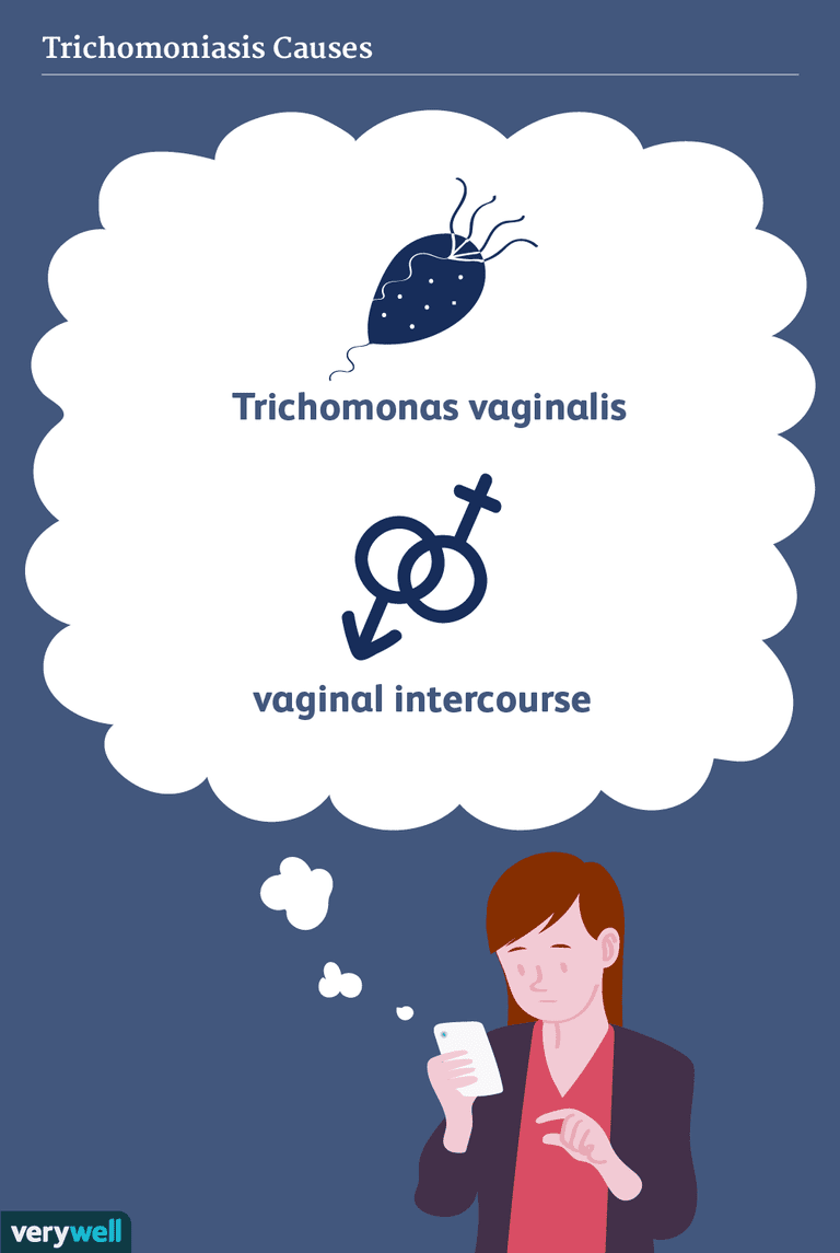seksueel overdraagbare, gevallen trichomoniasis, orale seks, Trichomonas vaginalis
