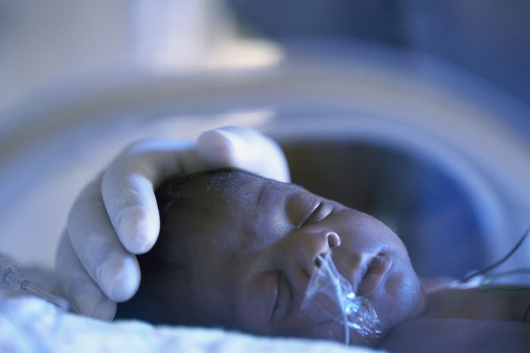 vroeg geboren, Chronische longziekte, geboren baby, geboren kinderen, komt voor