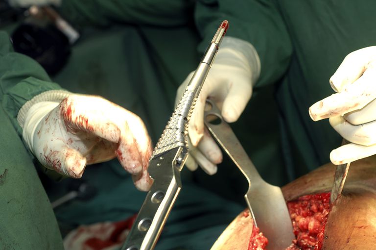 voor heupprothese, voor heupvervanging, kunstmatig implantaat, wordt uitgevoerd