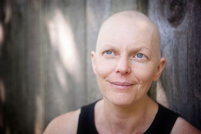 door chemotherapie, Sommige mensen, Veel mensen, aandacht haar, chemotherapie haarverlies, haar begint