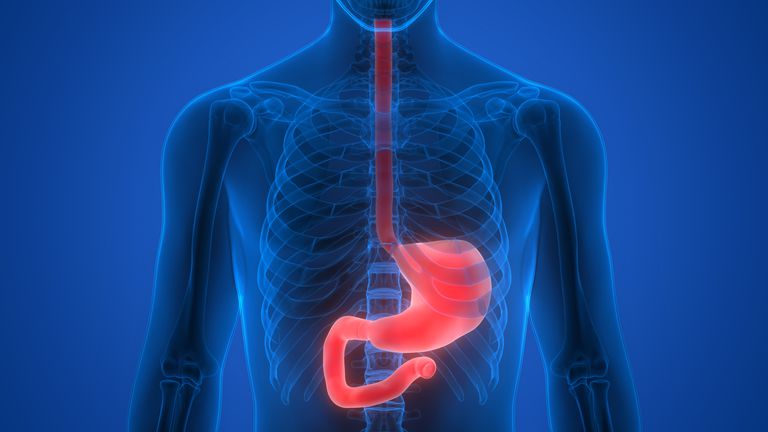 Crohn slokdarm, ziekte Crohn, bovenste endoscopie, slokdarm wordt, ziekte Crohn slokdarm