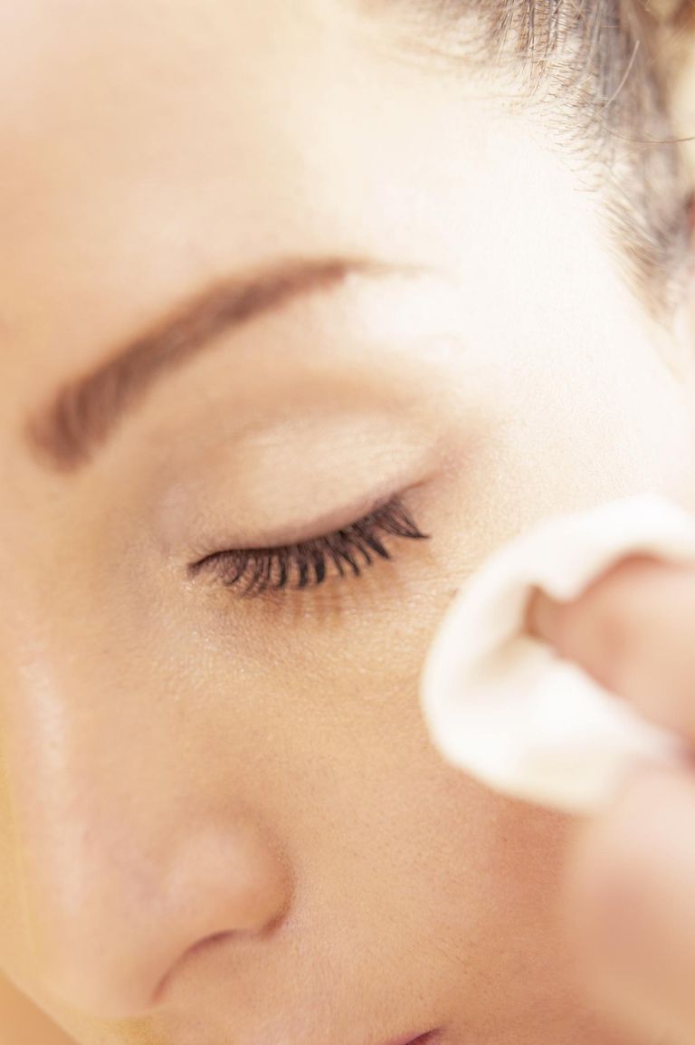 acne littekens, gebruik toner, kunnen helpen, voor huid, ​​toner gebruiken, bevat zoals