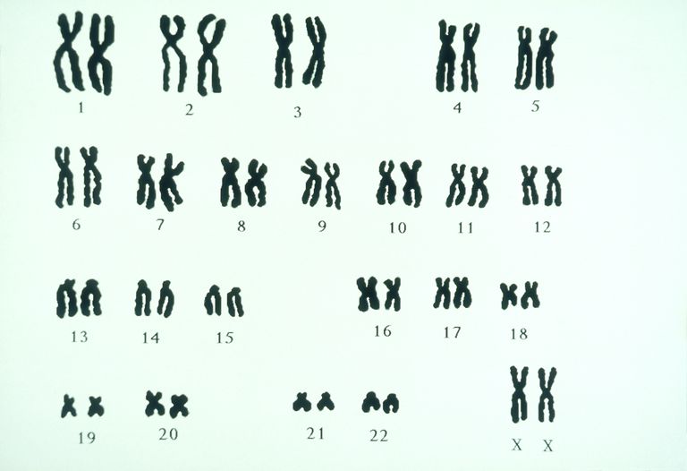 chromosomen persoon, FISH-analyse karyotype, aanwezig zijn, aanwezig zijn individu, alle chromosomen