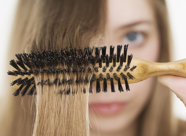 androgenetische alopecia, type haaruitval, type haarverlies, waarschuwt vrouwen