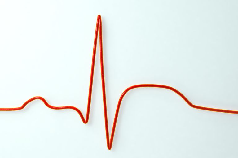 hartaanval hartstilstand, plotseling overleden, ventriculaire fibrillatie, veroorzaakt door, deel hartspier
