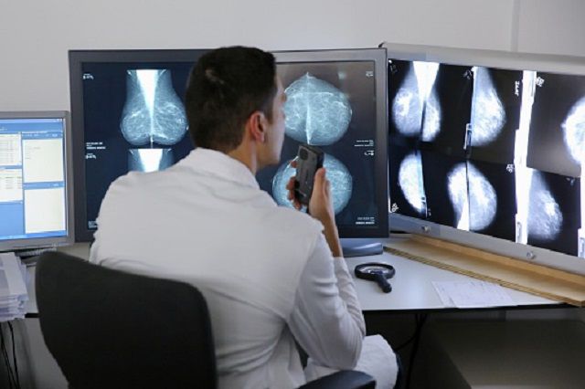 risico borstkanker, bedoeld voor, borstkanker verminderen, digitale mammografie, hoog risico, jaren 1940