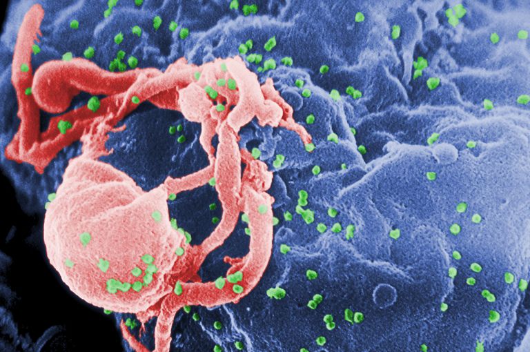 circulerende virus, mechanismen voor, naar AIDS