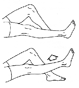 heup knie, Oefening voor, onderste ledematen, ledematen verbeteren