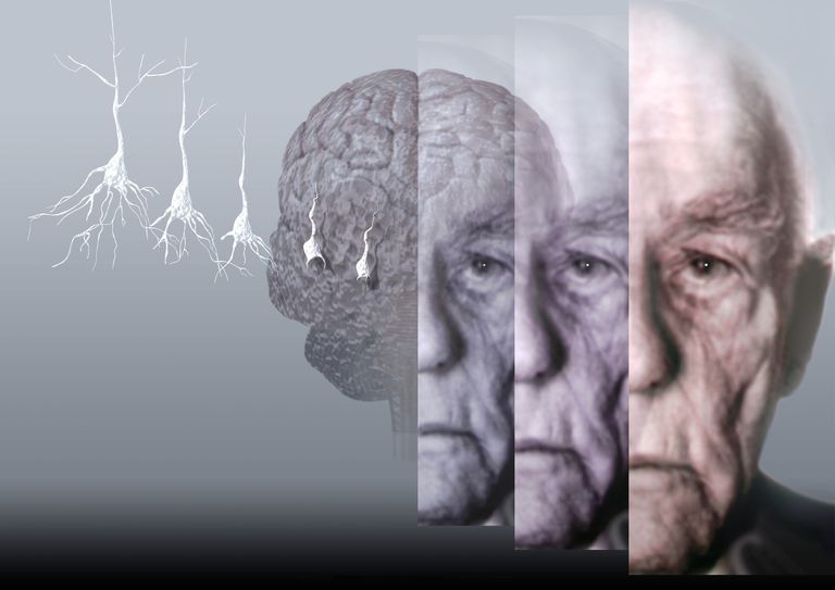 ziekte Alzheimer, uitdagend gedrag, A-B-C gedragsketen, staat voor, Alzheimer beïnvloedt, controleren voorkomen