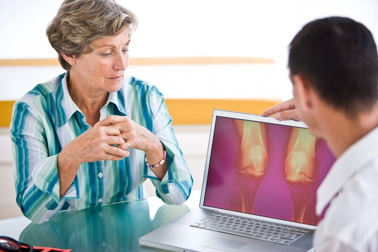 verhoogd risico, algemene bevolking, artrose knie, fysieke activiteit, geassocieerd verhoogd, Reumatoïde artritis