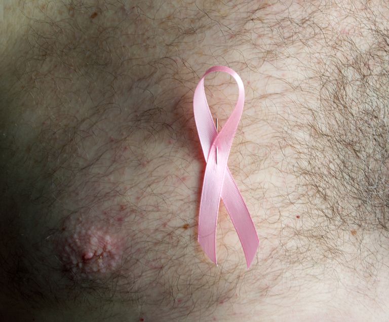borstkanker mannen, voor borstkanker, risico borstkanker, American Cancer, American Cancer Society, borstkanker verhogen