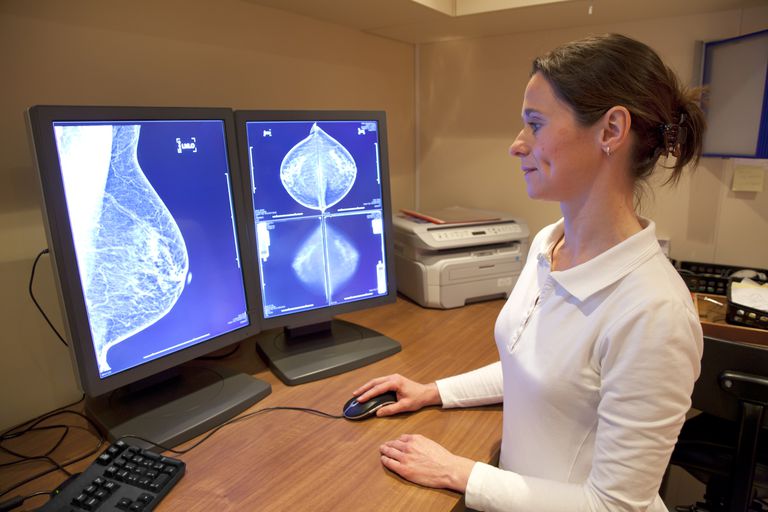 fijne naald, mammogram hebben, onder microscoop, worden gebruikt