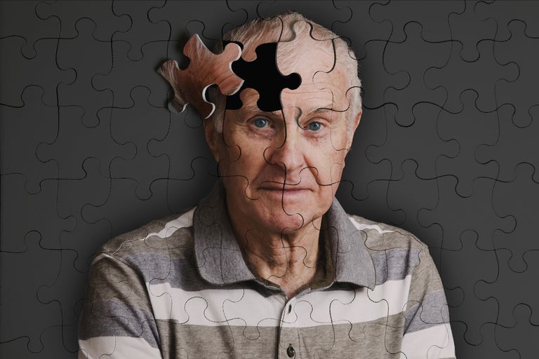 ziekte Alzheimer, middelbare leeftijd, begin ziekte, begin ziekte Alzheimer