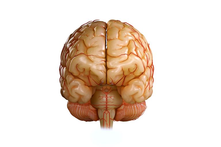 derde ventrikel, verschuiving middellijn, worden gebruikt, bevindt zich, centrum hersenen