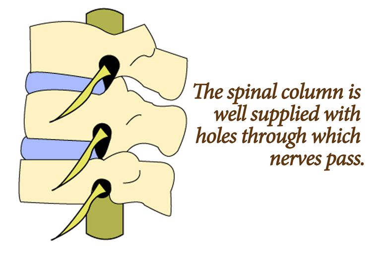spinale zenuwwortel, andere symptomen, door hernia, gaten zijkanten, gaten zijkanten wervelkolom
