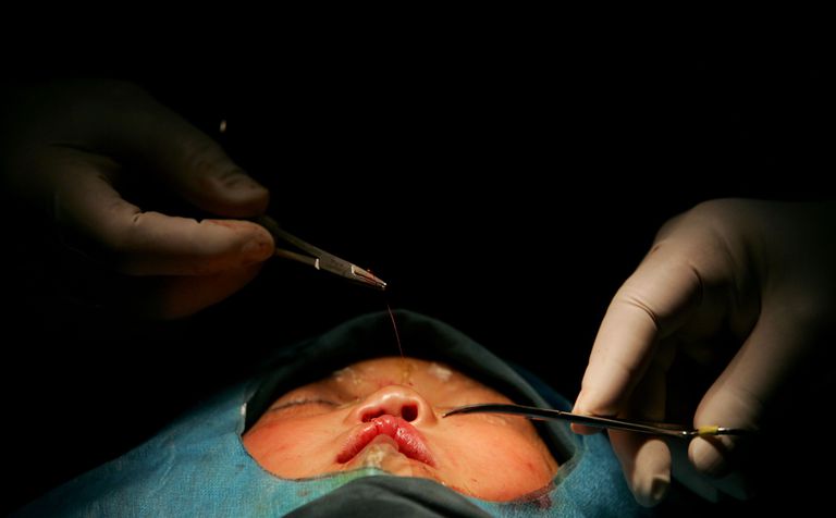 cosmetische chirurgie, Chirurgie wordt, plastische chirurgie, chirurgie richt, chirurgie richt zich