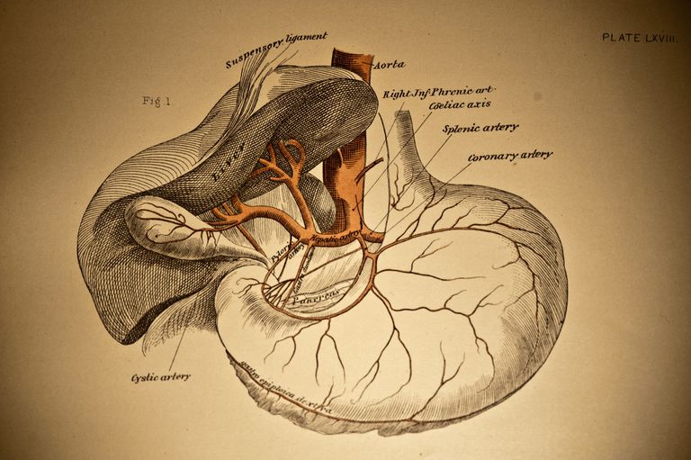 abdominaal aorta-aneurysma, geen symptomen, symptomen heeft, veel voorkomende