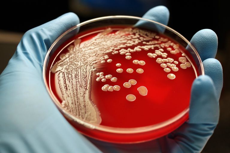 resistent tegen, Staphylococcus Aureus, andere persoon, besmet MRSA, cystic fibrosis