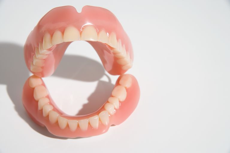 ontbrekende tanden, bovenste onderste, bovenste onderste tandboog, eerste paar, gebruikt wanneer, Gedeeltelijke prothesen