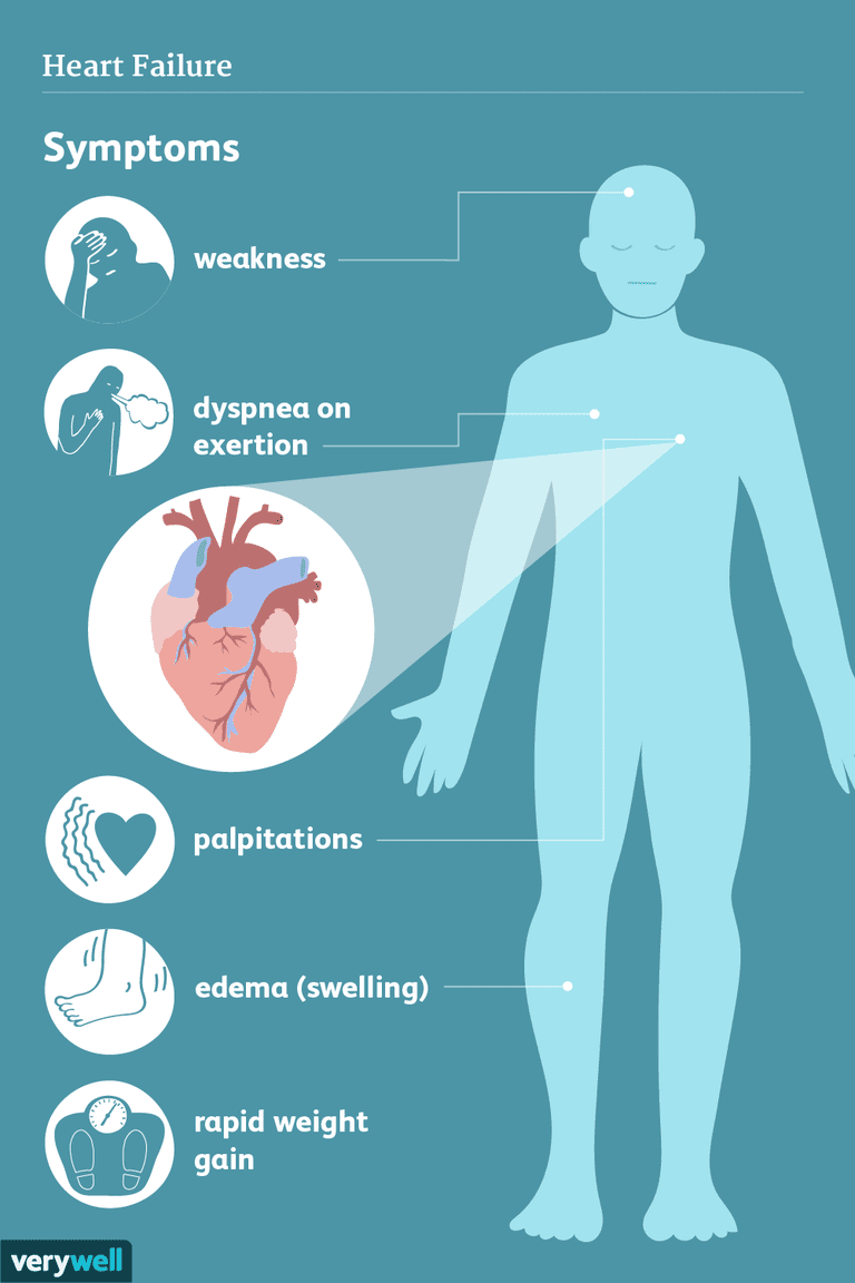 mensen hartfalen, veroorzaakt door, symptomen veroorzaakt, symptomen veroorzaakt door, persoon hartfalen