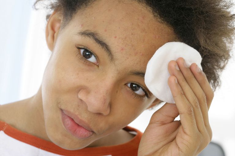 vette huid, grote poriën, overtollige olie, acne niet, acne verwijderen