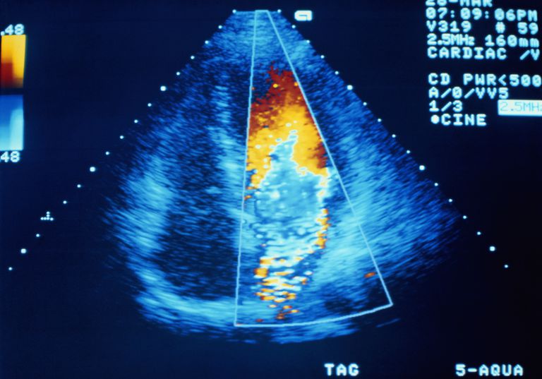 standaard echocardiogram, wordt uitgevoerd, achter hart, beelden genereren, bewegend beeld, cardiale beelden