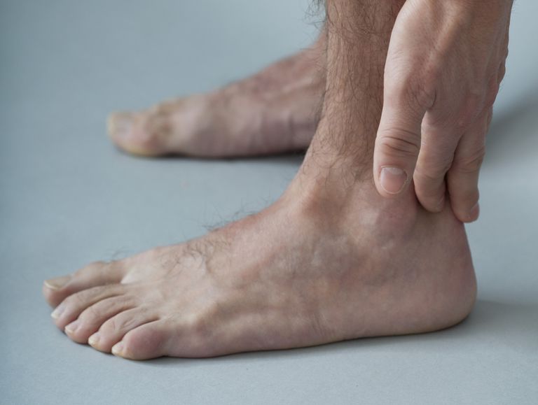 voet enkel, pijn zwelling, wordt meestal, Achilles tendinitis, achterkant enkel, bovenkant voet