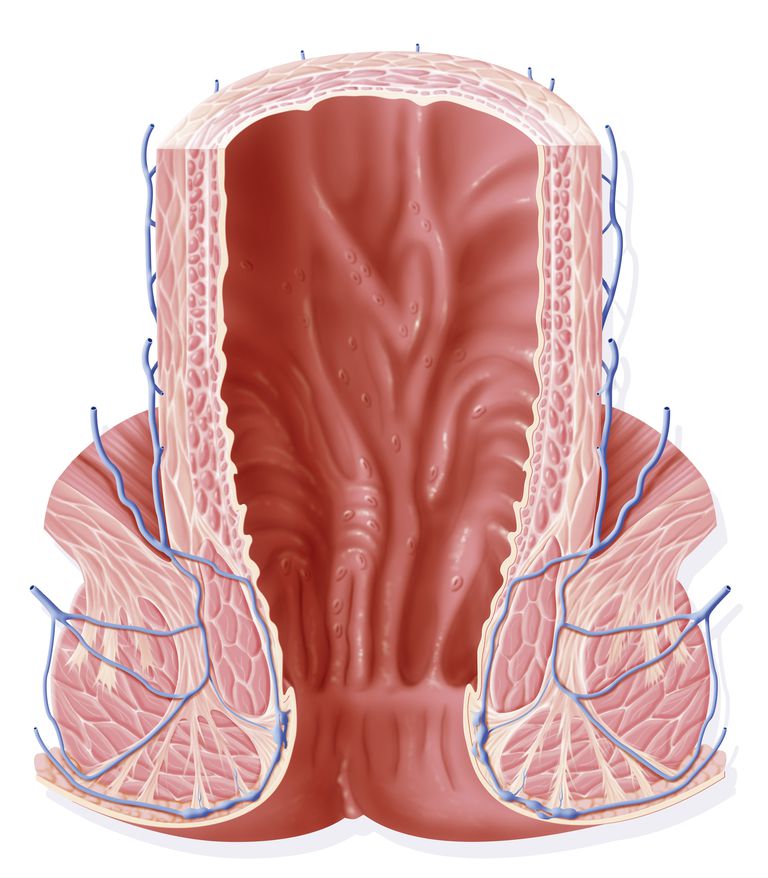 april 2015, York McGraw-Hill, bloed ontlasting, bloederige ontlasting, colorectale kanker, anale fissuren
