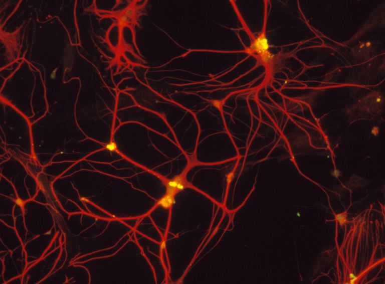 centrale zenuwstelsel, wordt genoemd, Radiale glia, veel meer, wordt verondersteld