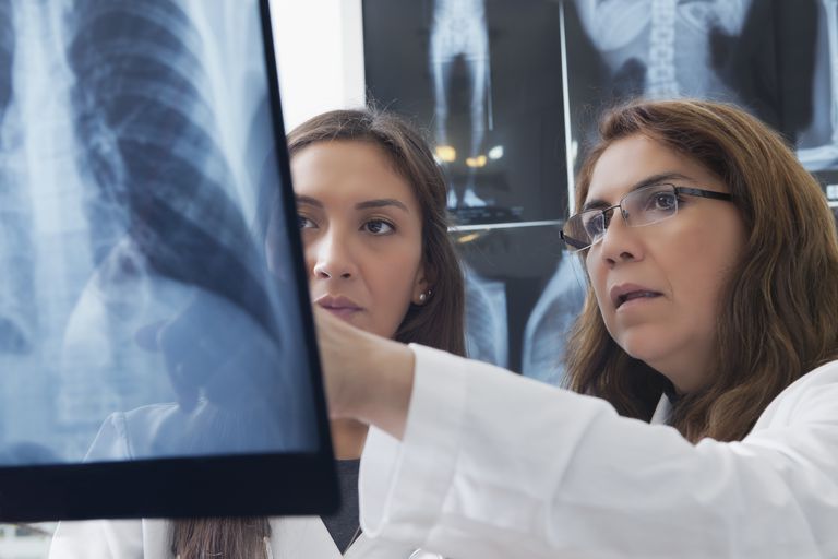 röntgenfoto borst, COPD stellen, diagnose COPD, diagnose COPD stellen
