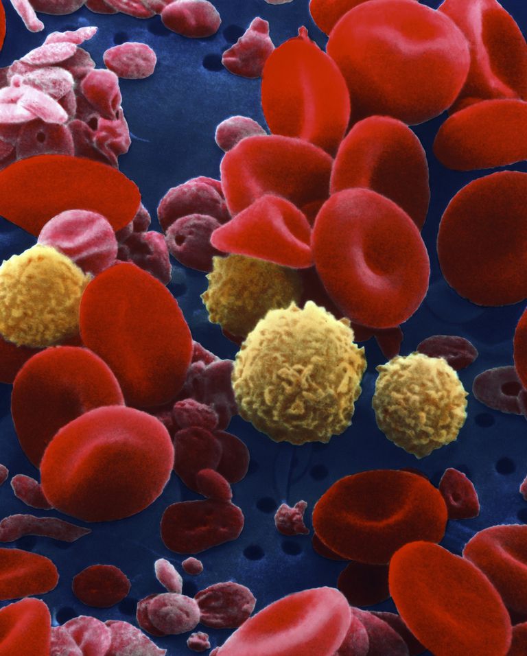 rode bloedcellen, genetische mutatie, risico kanker, aantal bloedplaatjes, beenmerg niet