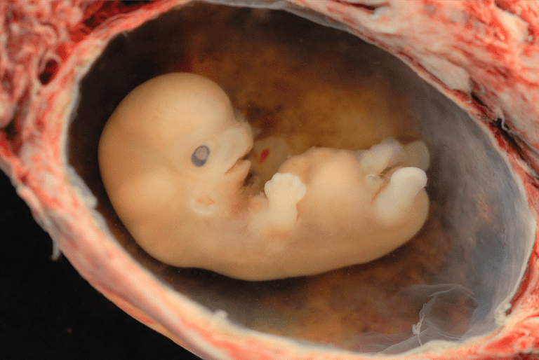 eerste trimester, tijdens zwangerschap, werden blootgesteld, aangeboren afwijkingen, antiretrovirale geneesmiddelen