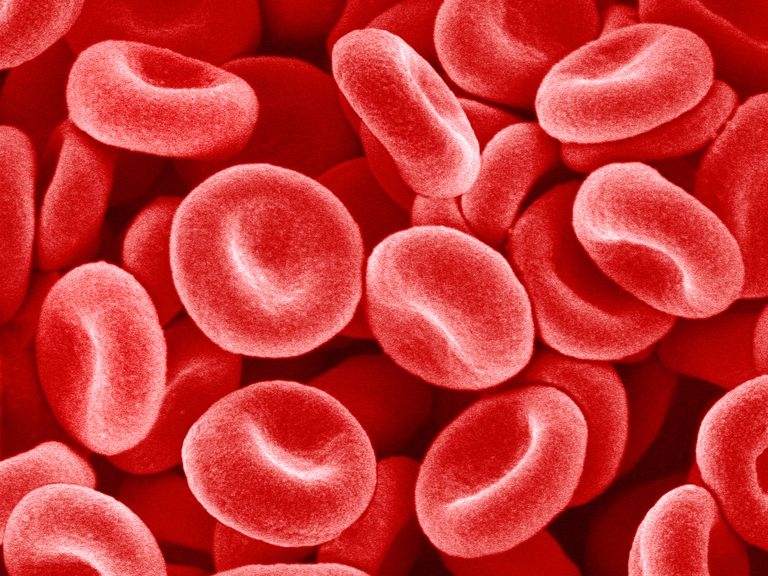 hemolytische anemie, rode bloedcellen, rode bloedcel, aantal reticulocyten