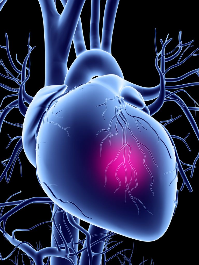 cholesterolgehalte bloed, afname procent, beroerte hartaanval, coronaire hartziekten, klinische onderzoeken, niet zeker